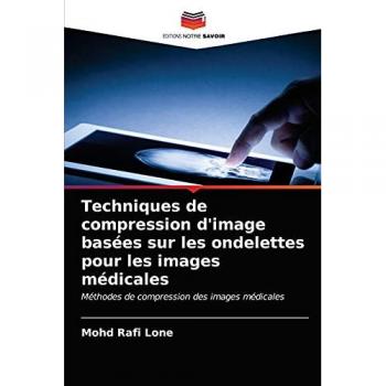 Techniques de compression d'image basées sur les ondelettes pour les images médicales: Méthodes de compression des images médicales