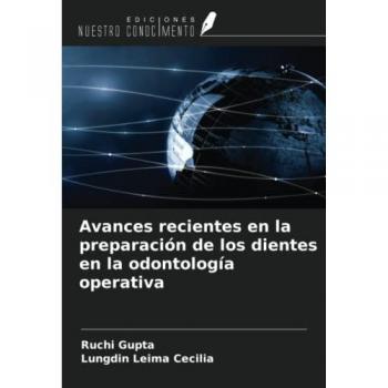 Avances recientes en la preparación de los dientes en la odontología operativa