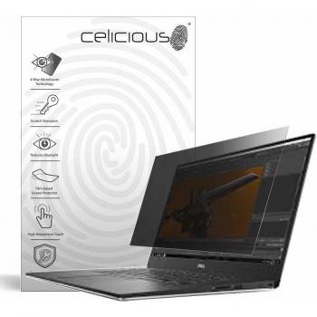 CeliShield Max – 4‑Way Anti‑Spy Protector for Dell Precision 15 5530