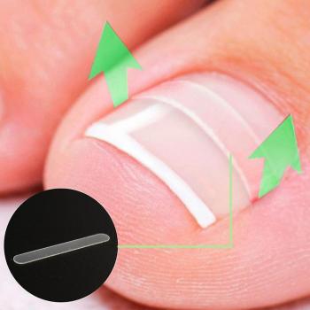 Correcteur d’ongle incarné – Pack 10 tampons