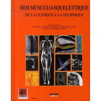 Irm Musculo-Squelettique