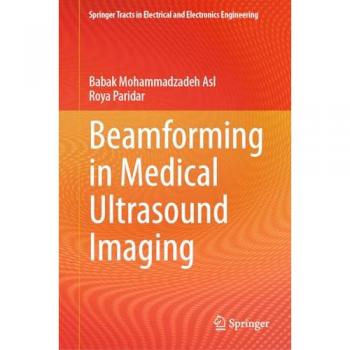 Paridar, Roya: Beamforming in Medical Ultrasound Imaging