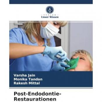 Post-Endodontie-Restaurationen