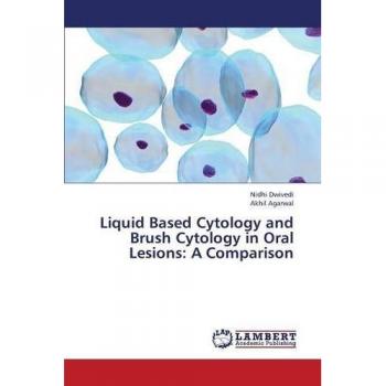 Liquid Based Cytology and Brush Cytology in Oral Lesions: A Comparison