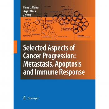 Selected Aspects of Cancer Progression: Metastasis, Apoptosis and Immune Response