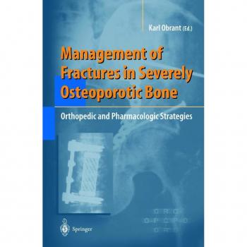 Management of Fractures in Severely Osteoporotic Bone