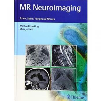 MR Neuroimaging: Brain, Spine, Peripheral Nerves
