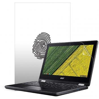 Acer Chromebook Spin 11 R751T UltraMatte Protective Cover – Glare Free