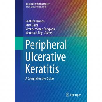 Peripheral Ulcerative Keratitis
