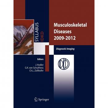 Musculoskeletal diseases 2009-2012. Diagnostic imaging