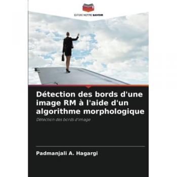Détection des bords d'une image RM à l'aide d'un algorithme morphologique: Détection des bords d'image