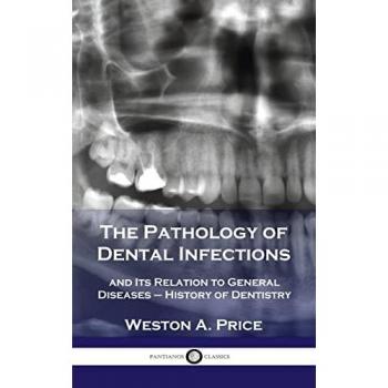 Pathology of Dental Infections: and Its Relation to General Diseases