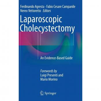 Laparoscopic Cholecystectomy