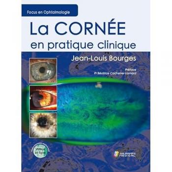 La cornee en pratique clinique
