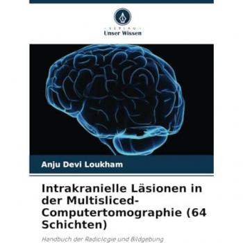 Intrakranielle Läsionen in der Multisliced-Computertomographie (64 Schichten)
