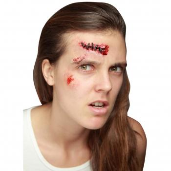 Genäherte Pflegestufe – Generique Wunde