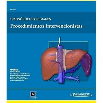 Diagnóstico por Imagen. Procedimientos Intervencionistas: Procedimientos intervencionistas.