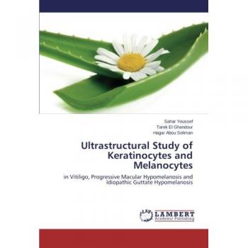 Ultrastructural Study of Keratinocytes and  Melanocytes: in Vitiligo, Progressive  Macular  Hypomelanosis  and  Idiopathic Guttate  Hypomelanosis