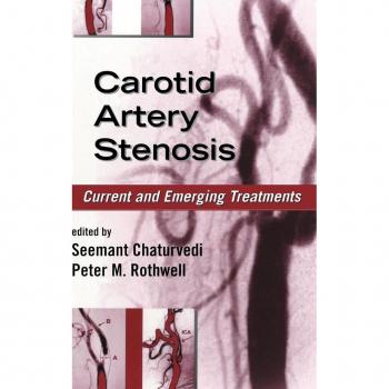 Marcel Dekker, Inc. Carotid Artery Stenosis (Hardback)