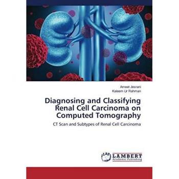Diagnosing and Classifying Renal Cell Carcinoma on Computed Tomography: CT Scan and Subtypes of Renal Cell Carcinoma