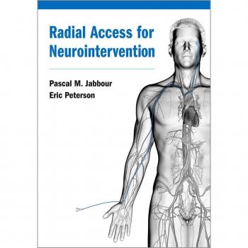 Radial Access for Neurointervention