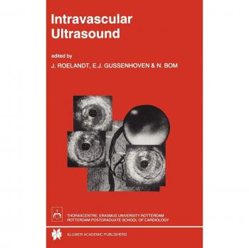 Intravascular Ultrasound: 143