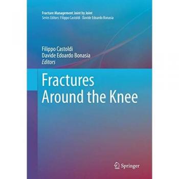 Fractures Around the Knee (Fracture Management Joint by Joint)
