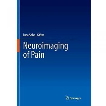Neuroimaging of Pain