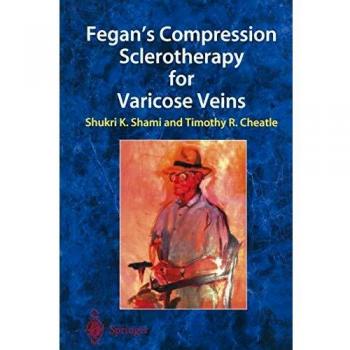 Fegan¿s Compression Sclerotherapy for Varicose Veins