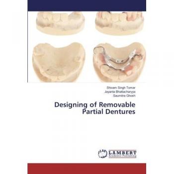 Designing of Removable Partial Dentures