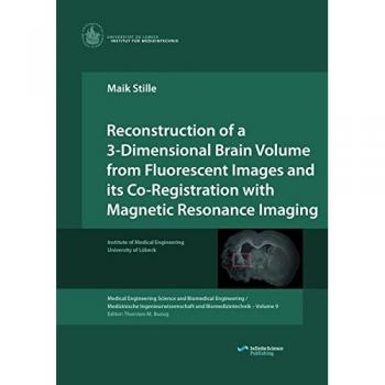Reconstruction of a 3-Dimensional Brain Volume from Fluorescent Images and its Co-Registration with Magnetic Resonance Imaging (Medical Engineering ... Ingenieurwissenschaft und Biomedizintechnik)