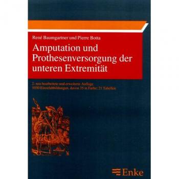 Amputation und Prothesenversorgung der unteren Extremität