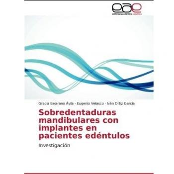 Sobredentaduras mandibulares con implantes en pacientes edéntulos: Investigación