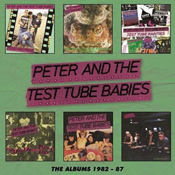 The Albums 1982-1987 Coffret