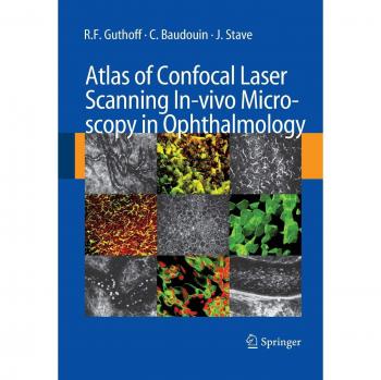 Atlas of Confocal Laser Scanning In-vivo Microscopy in Ophthalmology: Principles and Applications in Diagnostic and Therapeutic Ophtalmology