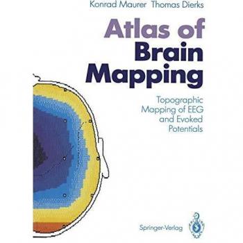 Atlas of Brain Mapping: Topographic Mapping of Eeg and Evoked Potentials