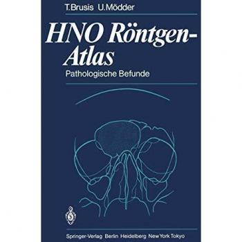H.N.O. Röntgen-Atlas: Pathologische Befunde (German Edition)