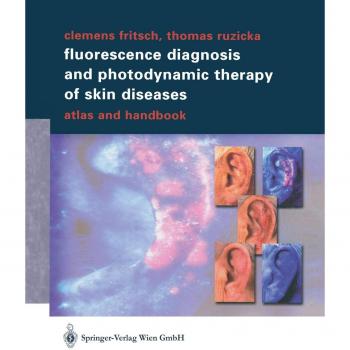 Fluorescence Diagnosis and Photodynamic Therapy of Skin Diseases