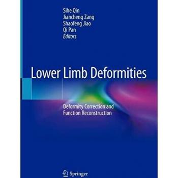 Lower Limb Deformities