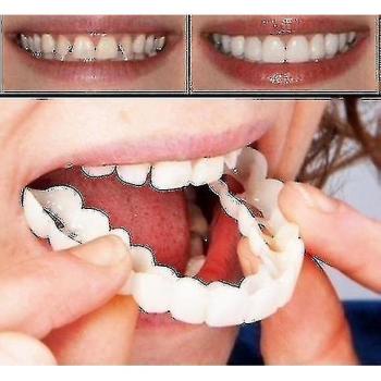Instant Smile Conly Prothèse Supérieure Inférieure