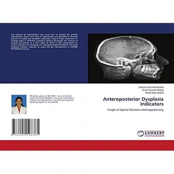 Ravada, Sathya Usha Sree: Anteroposterior Dysplasia Indicators