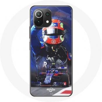 Xiaomi Mi 11 Lite Case