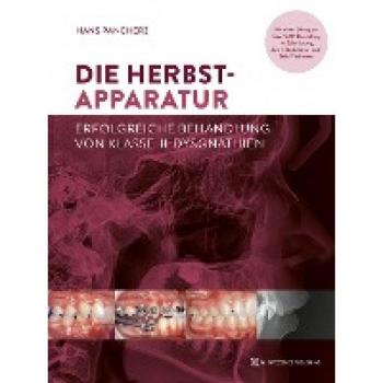 Die Herbst-Apparatur