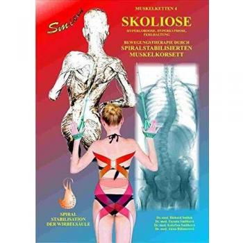 Skoliose: Bewegungstherapie durch spiralstabilisierten Muskelkorsett