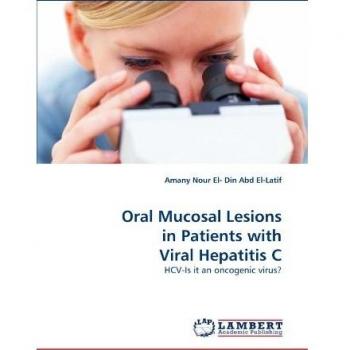 Oral Mucosal Lesions in Patients with Viral Hepatitis C: HCV-Is it an oncogenic virus?