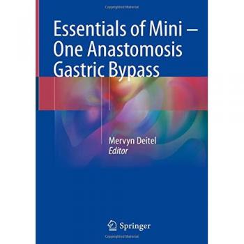 Essentials of Mini