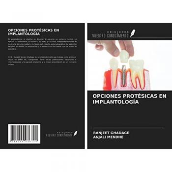 OPCIONES PROTÉSICAS EN IMPLANTOLOGÍA