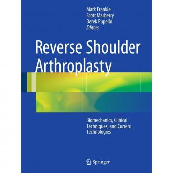 Reverse Shoulder Arthroplasty