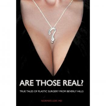 Are Those Real?: True Tales of Plastic Surgery from Beverly Hills