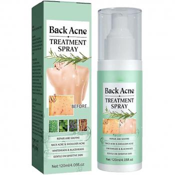 Mysept Solution Spray Acné 120ml